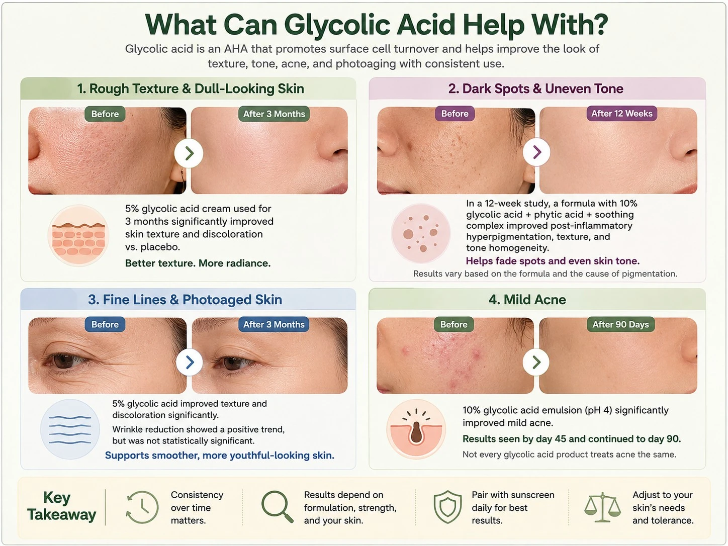 What Can Glycolic Acid Help With showing rough texture dark spots photoaging fine lines and mild acne - Zicail Beauty What Can Glycolic Acid Help With showing rough texture dark spots photoaging fine lines and mild acne - Glycolic Acid for Skin: Benefits, Uses & How to Use It