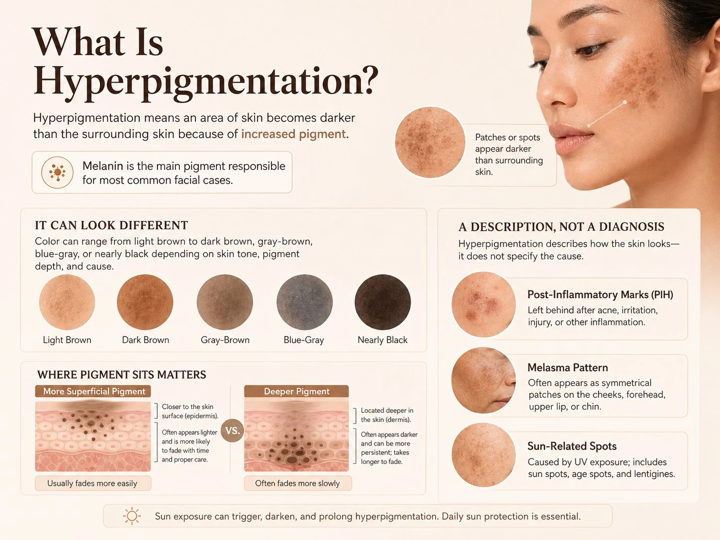 What Is Hyperpigmentation showing melanin dark spots pigment depth PIH melasma and sun related discoloration - Zicail Beauty What Is Hyperpigmentation showing melanin dark spots pigment depth PIH melasma and sun related discoloration - Hyperpigmentation: Causes, Types & How to Fade Dark Spots